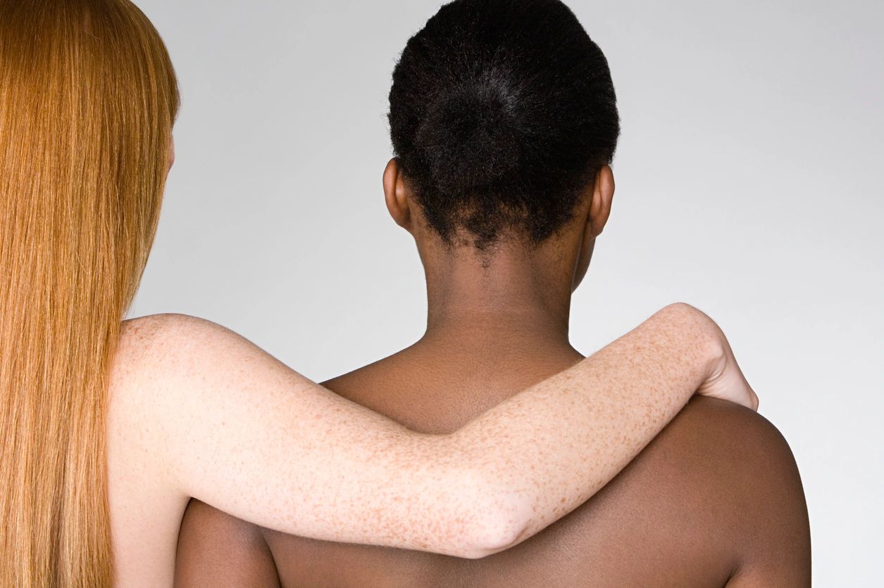 MCAS in Women: Understanding Hormones, Food Sensitivites and Holistic Support